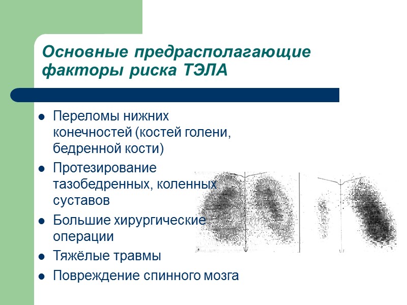 Основные предрасполагающие факторы риска ТЭЛА Переломы нижних конечностей (костей голени, бедренной кости)  Протезирование
